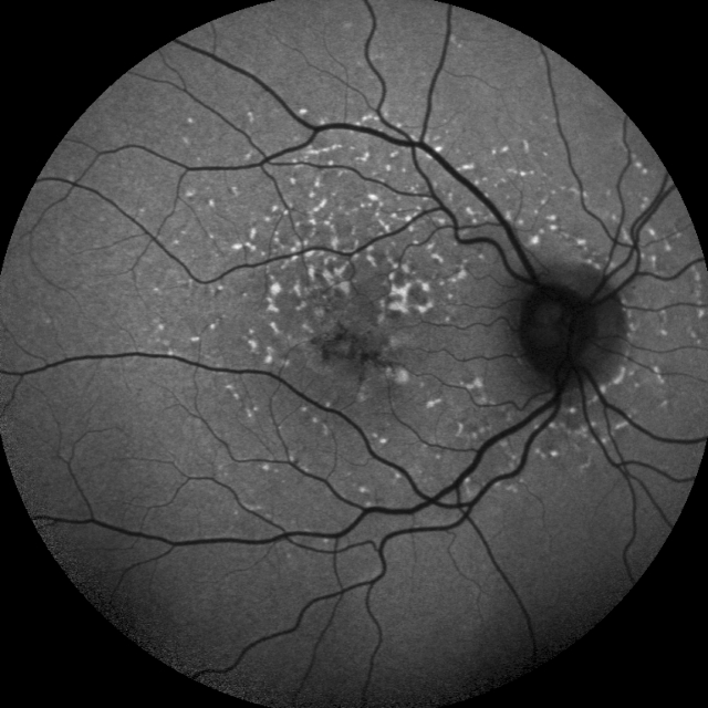 Retinal image